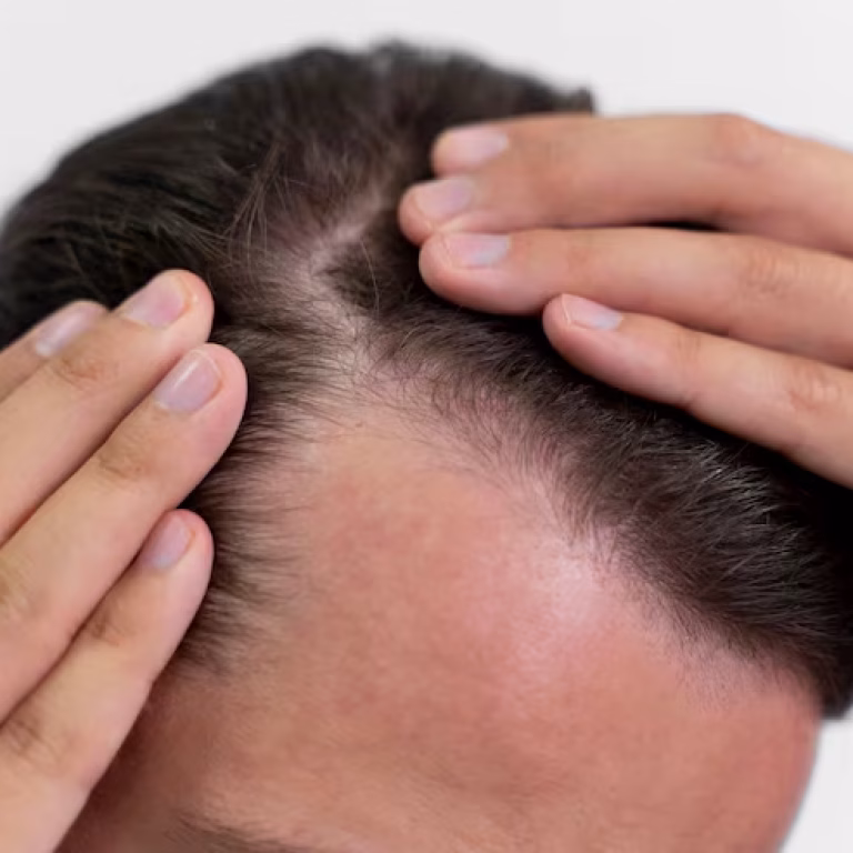 homem-adulto-olhando-para-o-cabelo_23-2149106319
